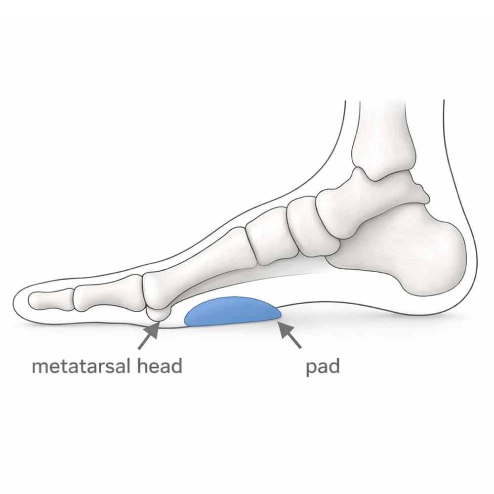 Metatarsal Pad Position 1