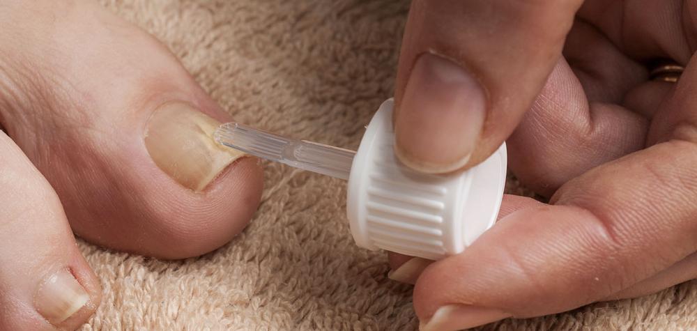 Fungal Nail Treatment