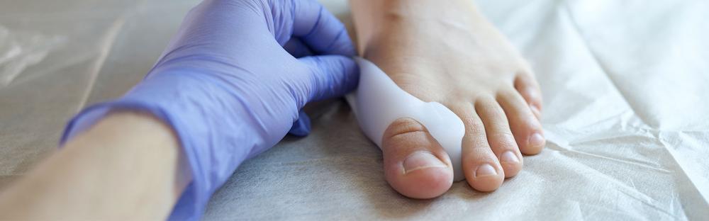 Hallux Valgus Splint
