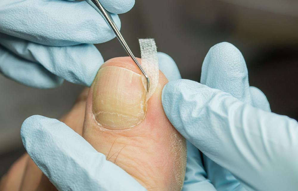 Podiatry Probe