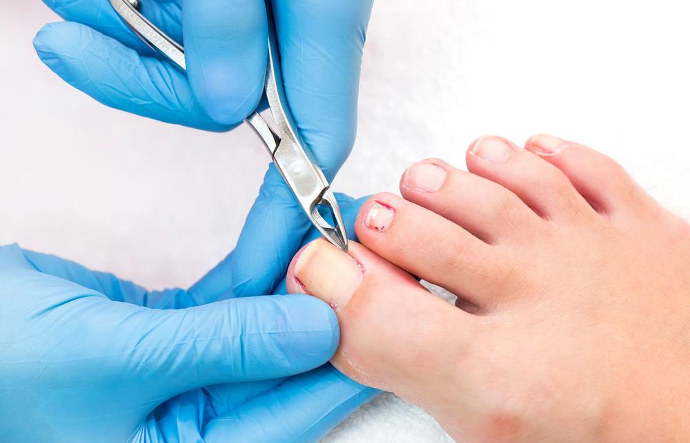 Podiatry Instruments