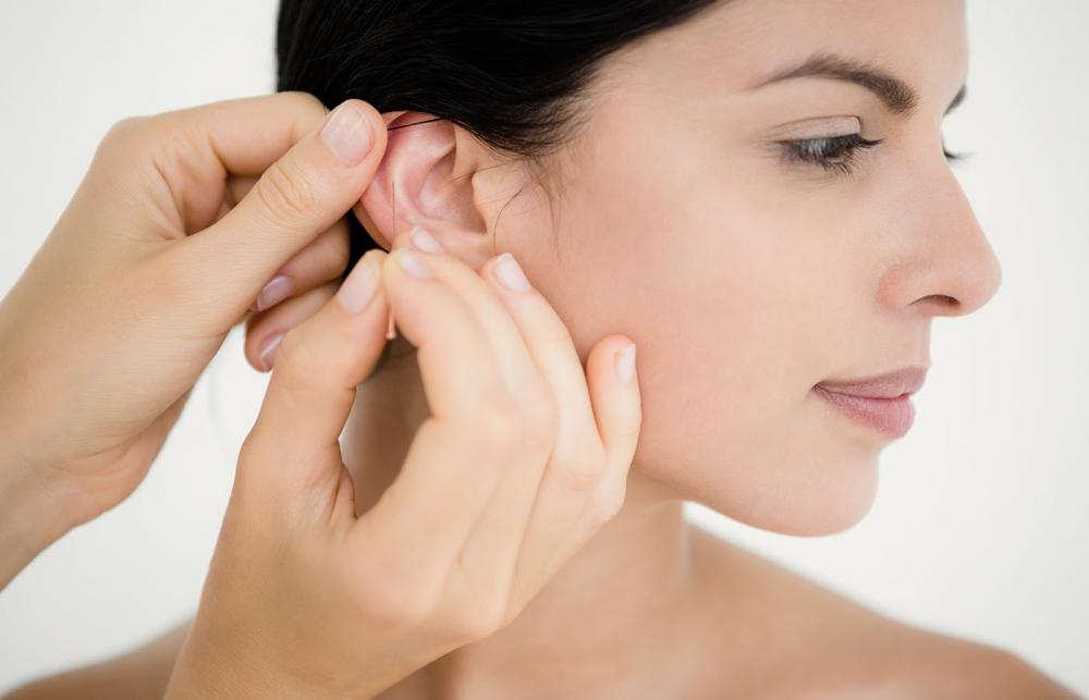 Selecting the right acupuncture needles