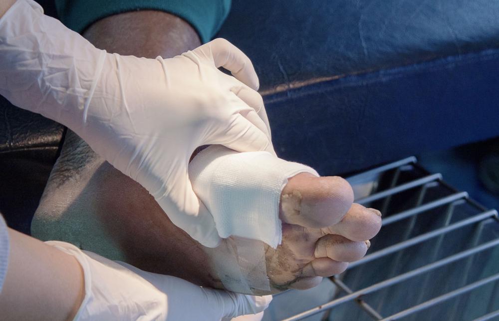 Foot Wound Dressing