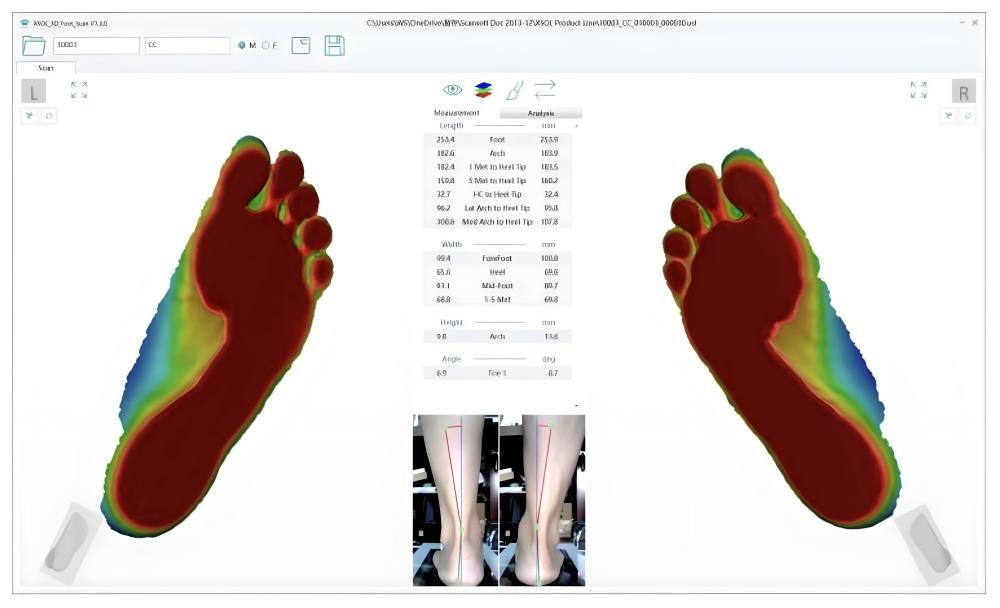 Foot Scan 2