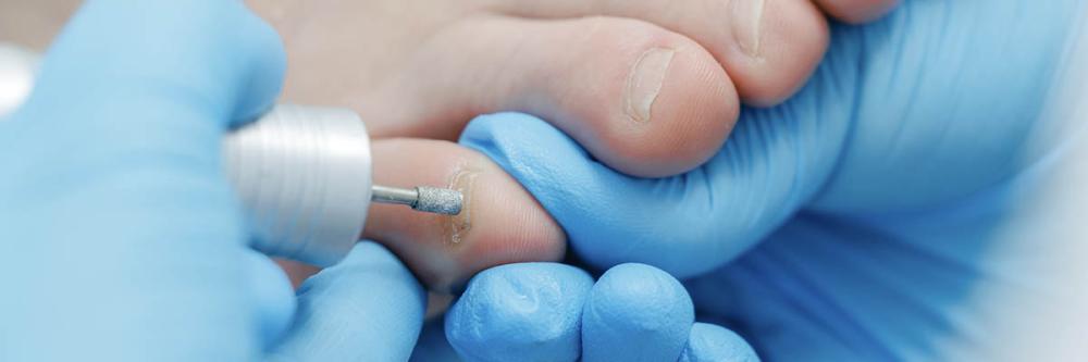 Podiatrist Working on Nails with Drill