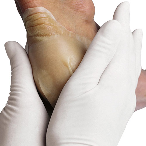 Hydrocolloid wound dressing with border