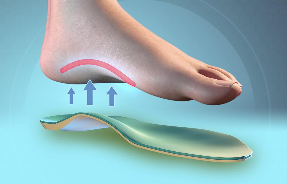Insole Load