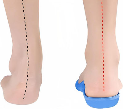 Arch Support Insoles