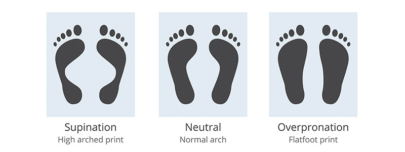 Foot Supination