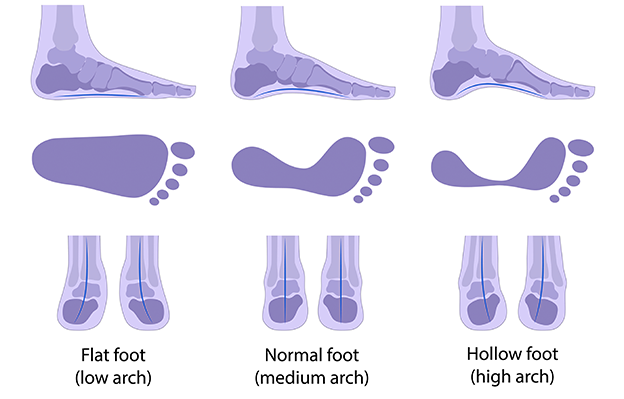 Foot Types