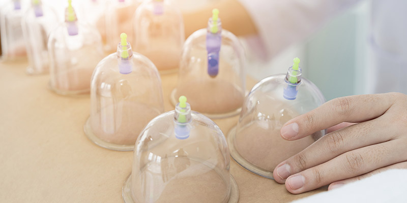 Cup Acupuncture 