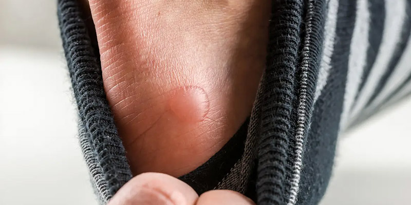 Photo of Foot Bister