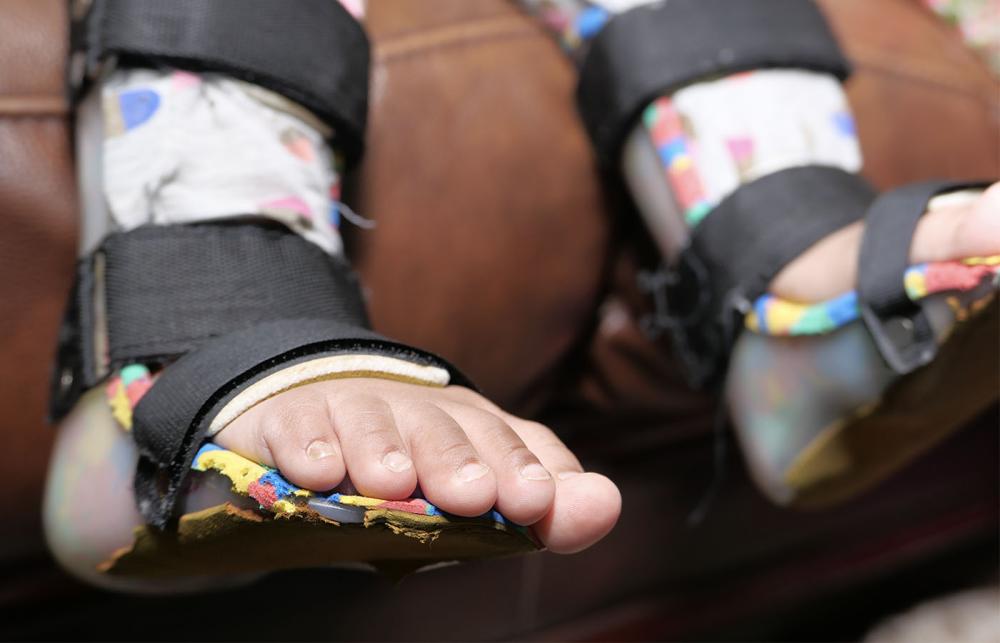 Paediatric AFO (Ankle Foot Orthosis)