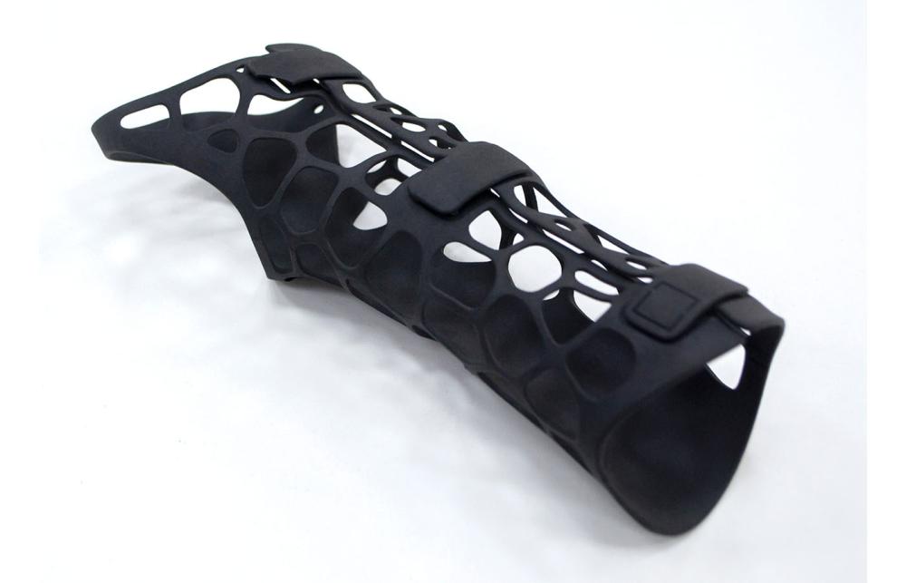 3D Printed Wrist Orthosis