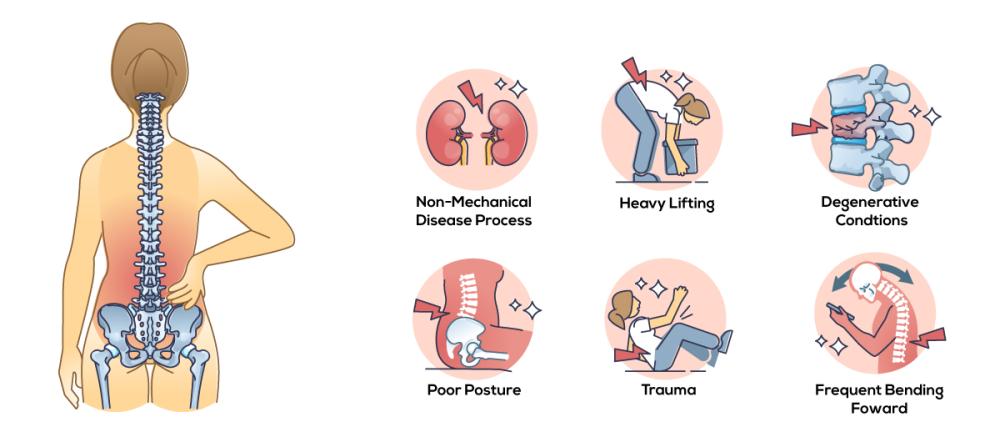 Back Pain Causes