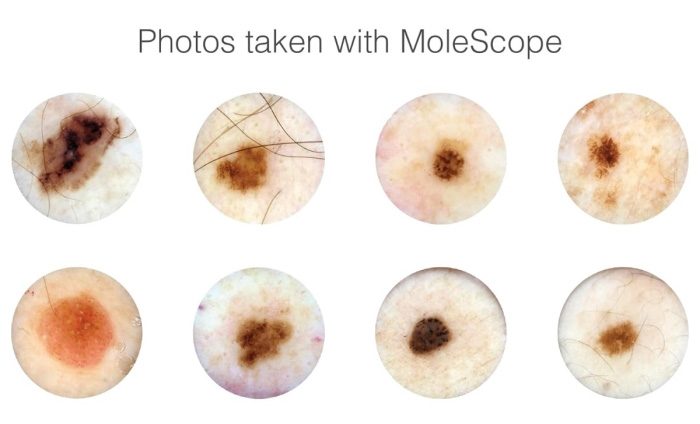 Mole Inspection