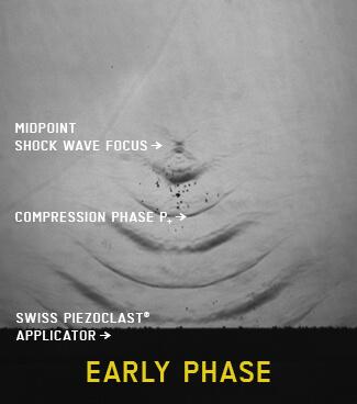 EMS_Swiss_DolorClast_XRay_368x325px_Focused_EarlyPhase
