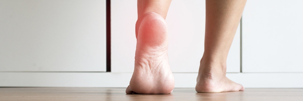 Footcare Products for Plantar Fasciitis