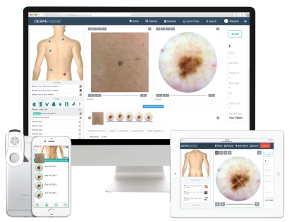 Dermatoscope for Clinicians