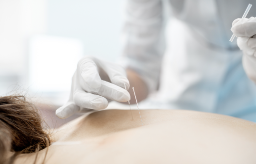 Acupuncture Needle Tube