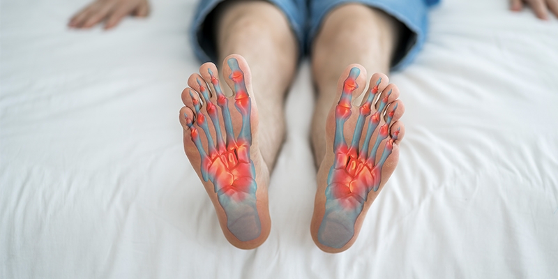 Curing Plantar Fasciitis 