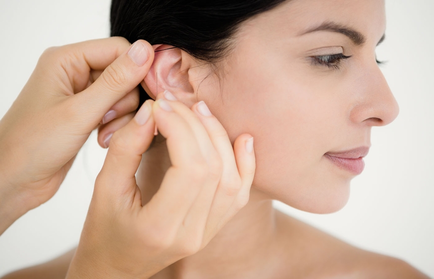 Ear Acupuncture