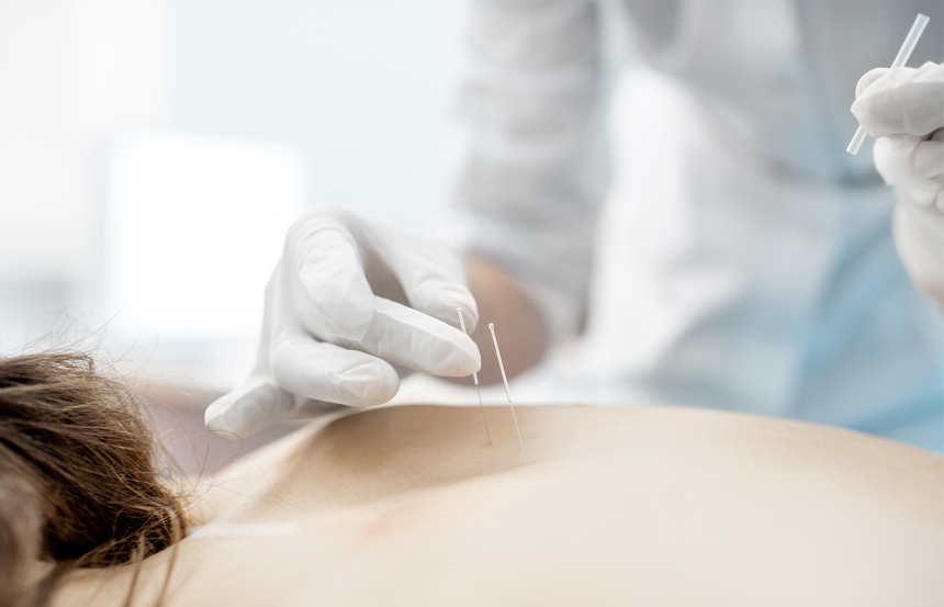Acupuncture Needle Tube