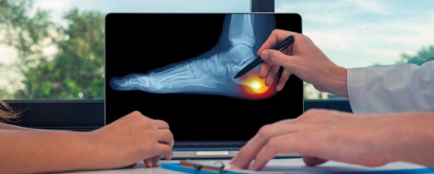 Orthotic Insoles
