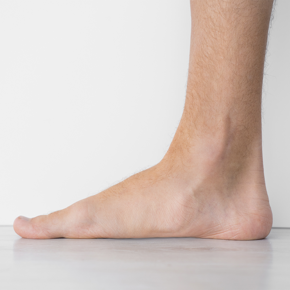 Arch Support Insoles for Flat Feet