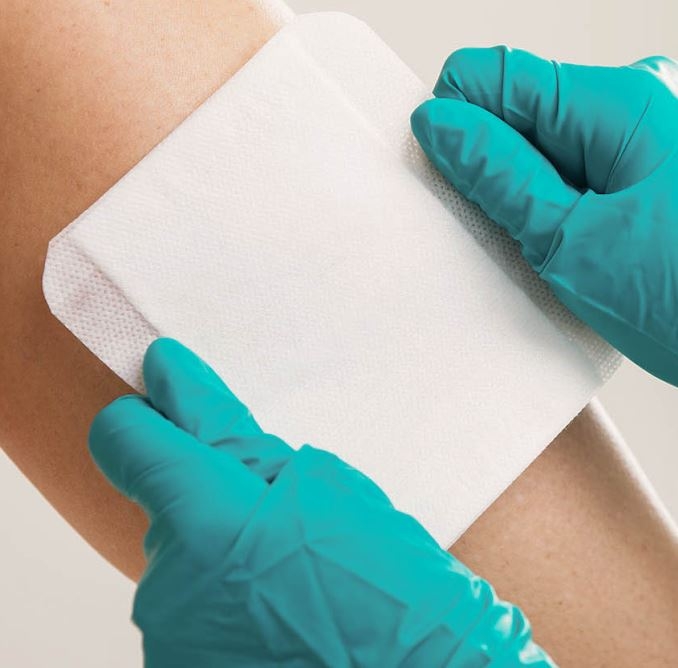 Alginate Wound Dressings