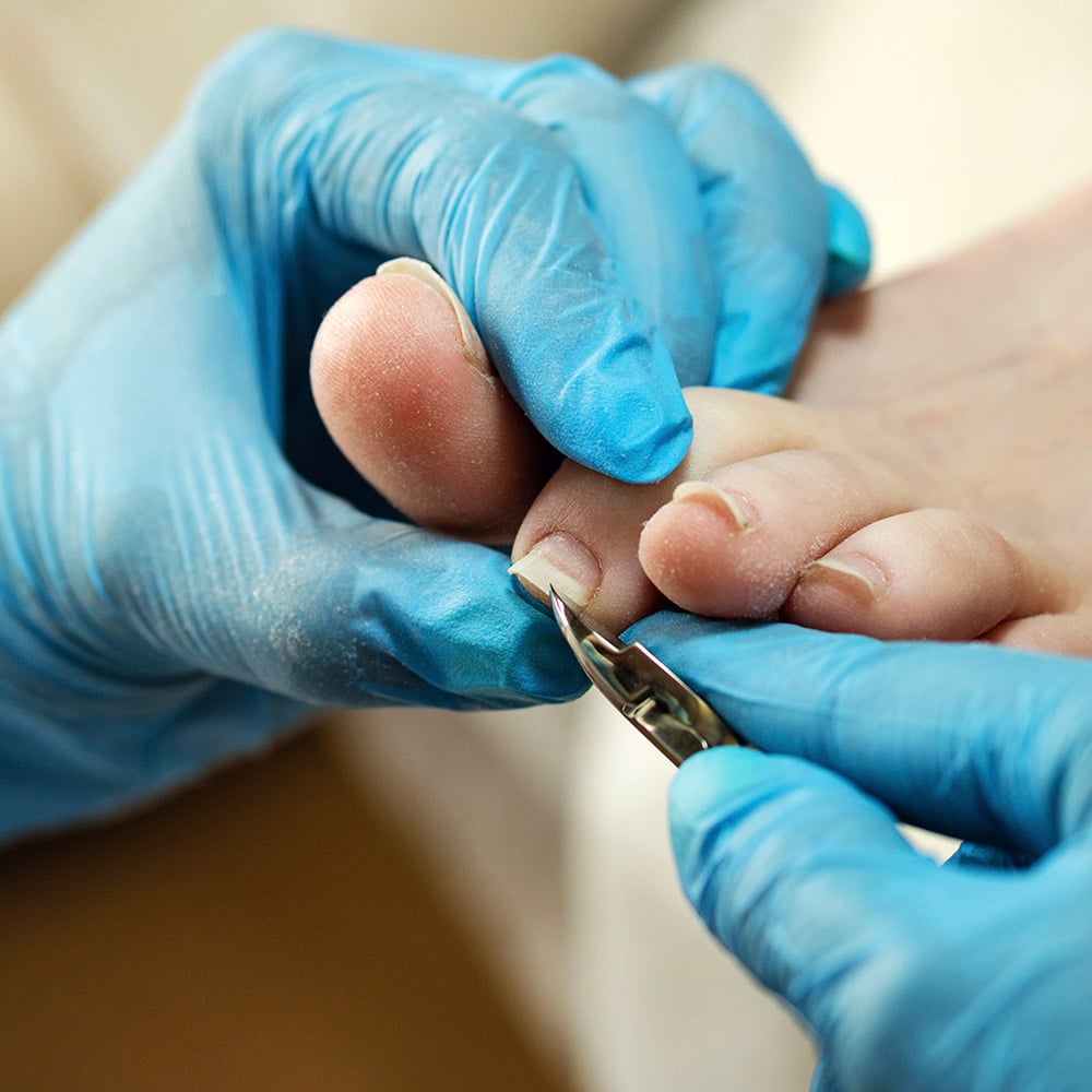 Diabetic Podiatry Nippers