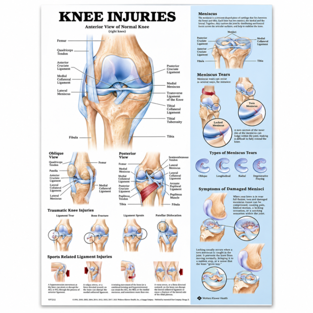 Knee Injuries Poster