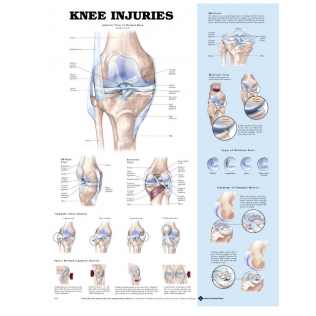 Knee Injuries Poster