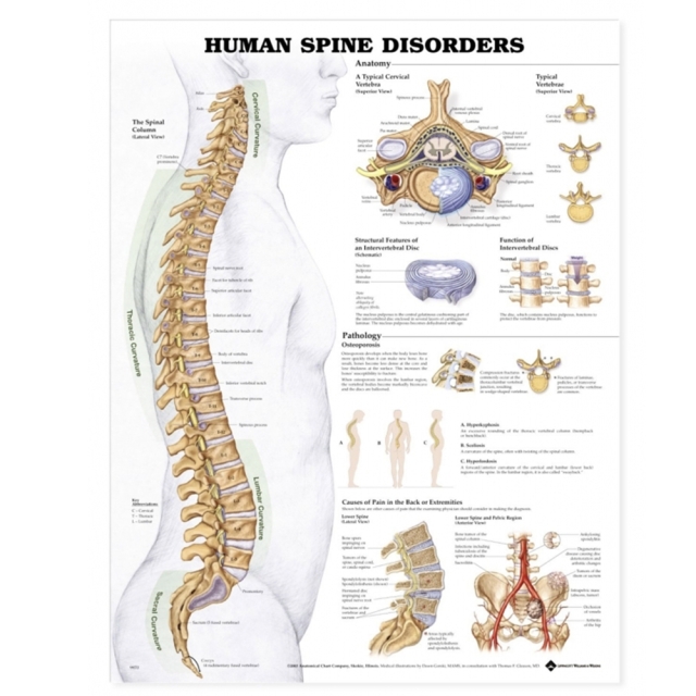Human Spine Disorders Anatomical Chart Poster