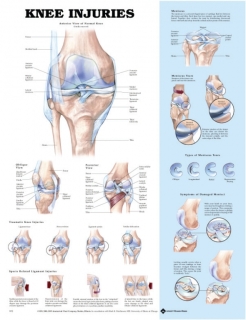 Knee Injuries Poster | Colour