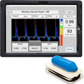BlueDop Cuffless Doppler System
