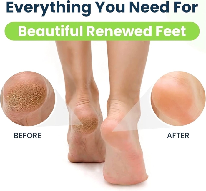 Plastic Foot File Double Sided Sander 20 PACK