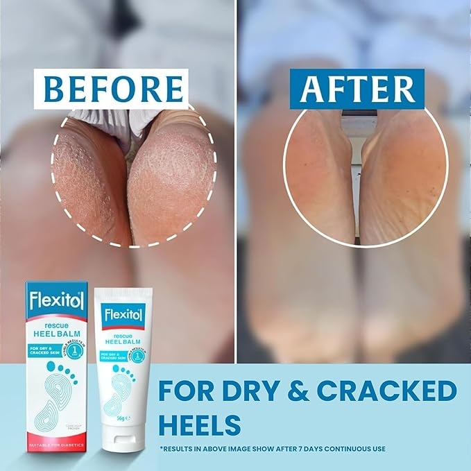 Buy Flexitol Heel Balm 5g| Intense Dry Skin Heel Repair Algeos