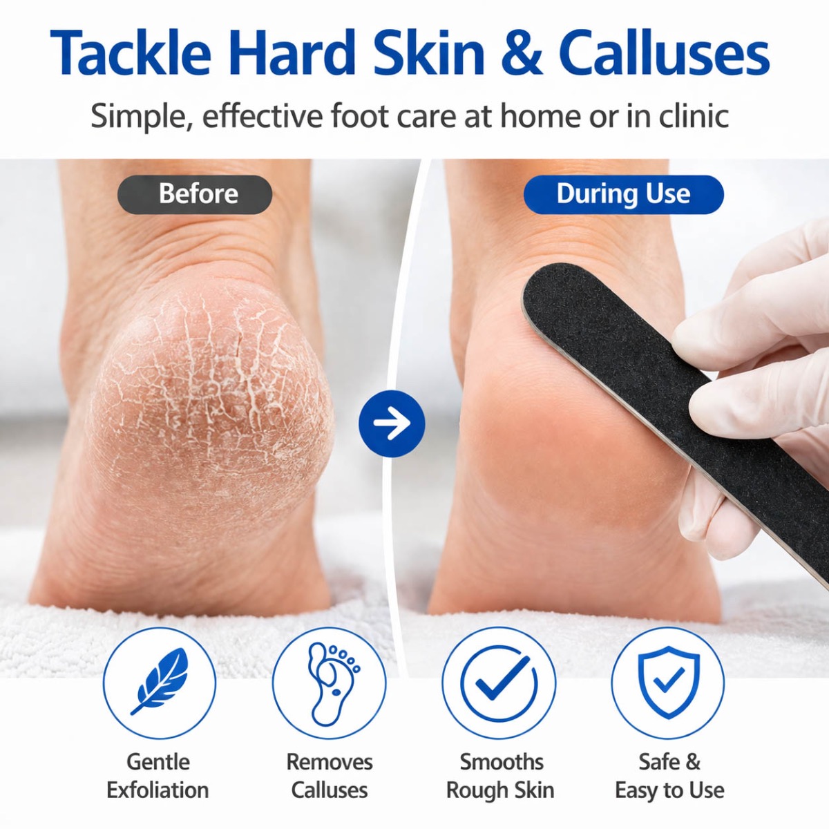 Foot File