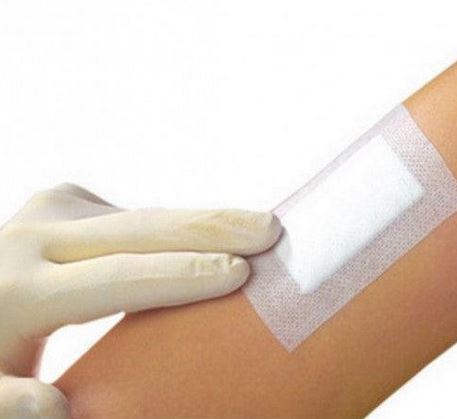 Wound Dressing