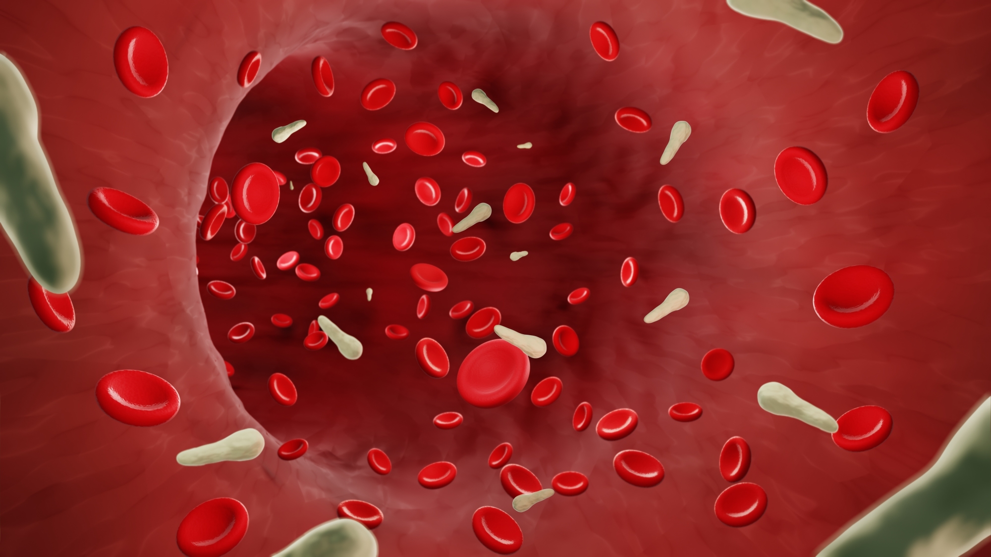 Blood stream with infected cells