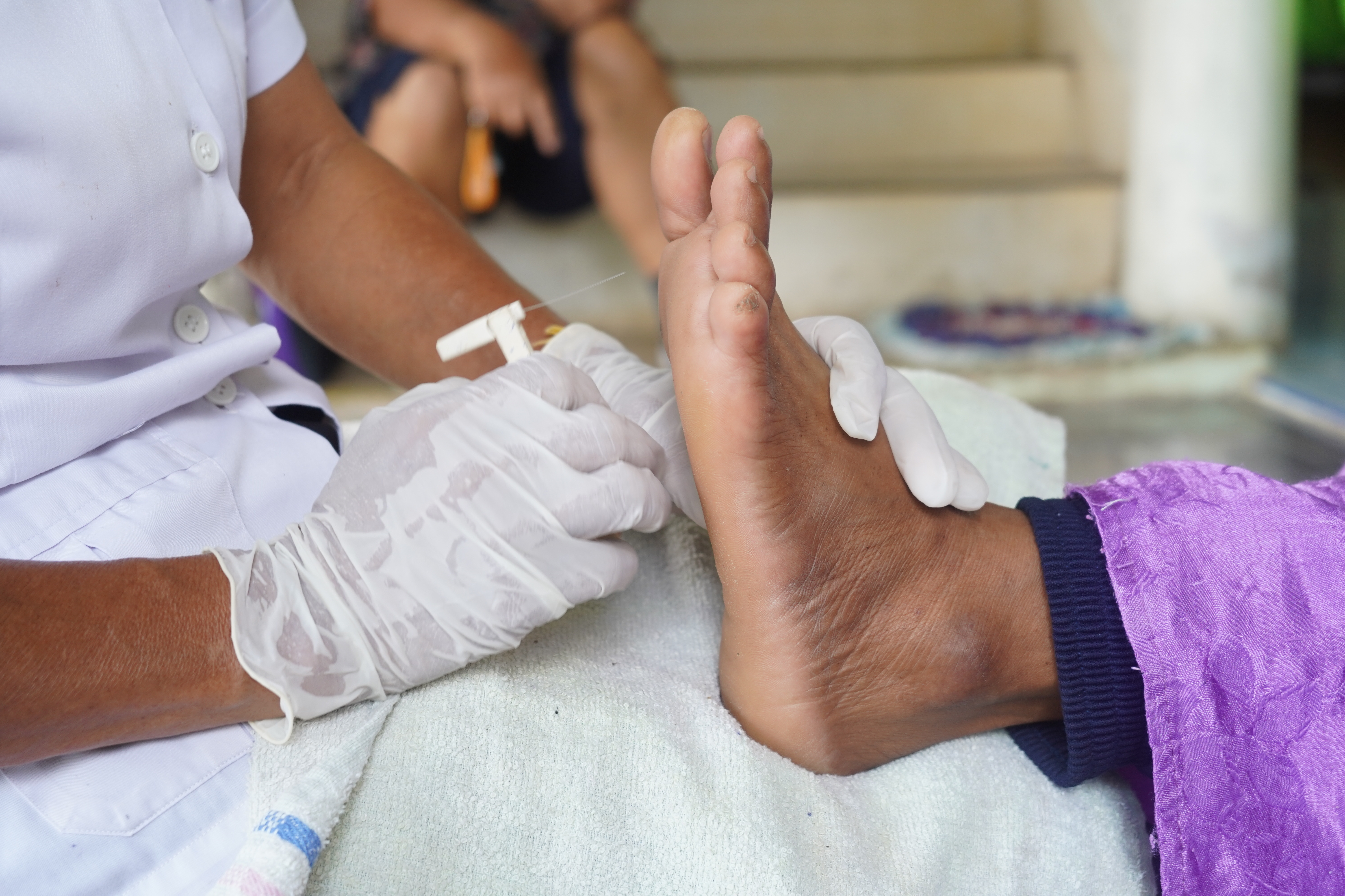 Diabetic Ulcer Test