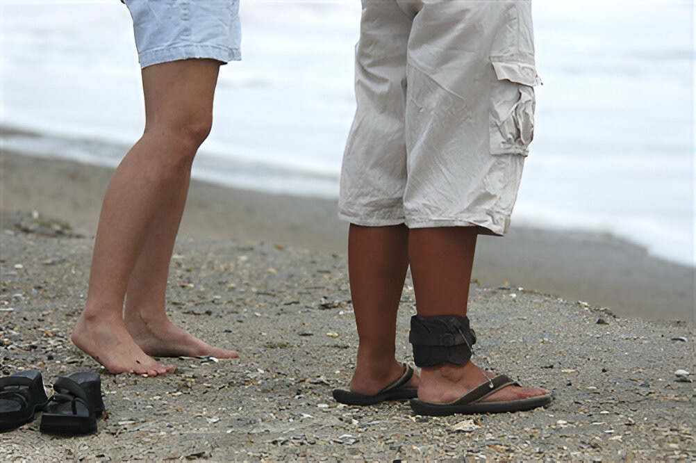 Drop Foot Condition
