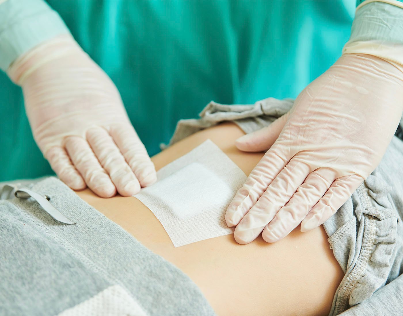 Wound Dressings Guide