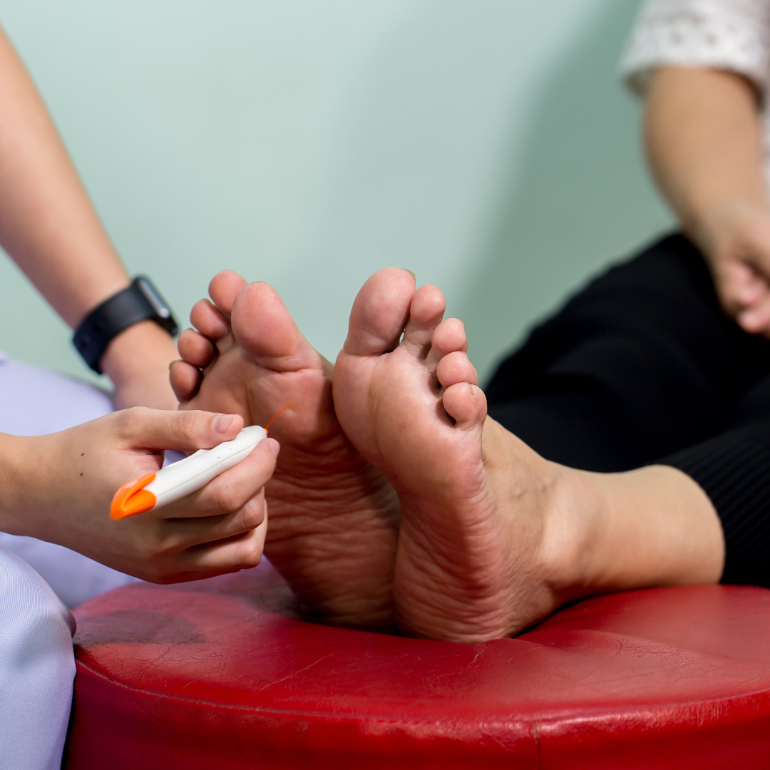 Podiatrist using Monofilament Tester on patients feet