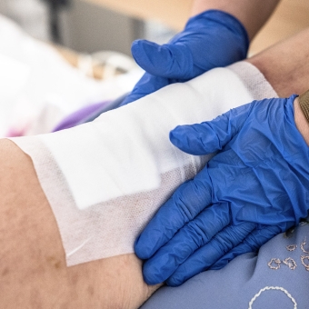 Pressure Sores