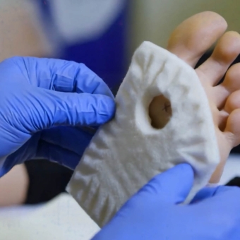 Chiropody Felt