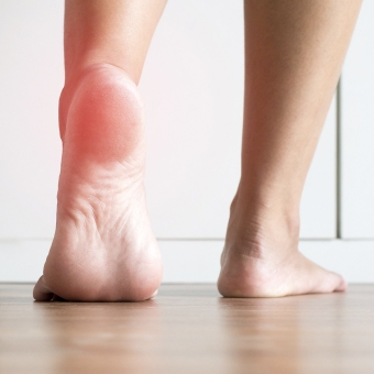 Plantar Fasciitis