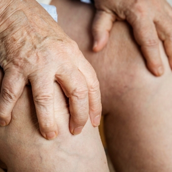 Osteoarthritis