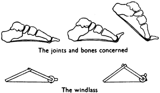 Windlass